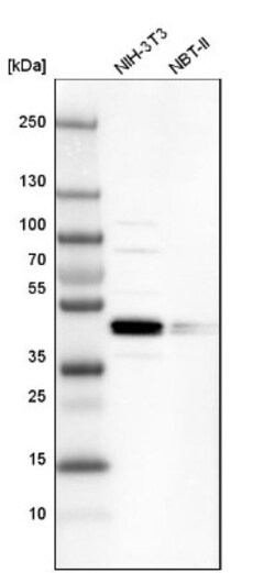 SMAP2 Antibody, Novus Biologicals:Antibodies:Primary Antibodies